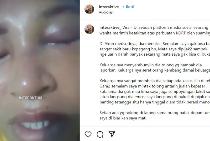 Viral?? Wanita Ini Alami KDRT Brutal di Rokan Hulu Riau: Mata Dipijak, Suami Kabur Bawa Honda!